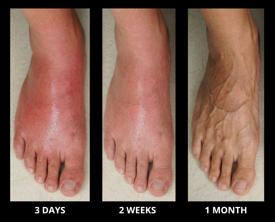 Nerve Restore